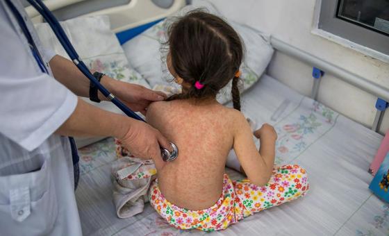 Opas vê risco “muito alto” de propagação do sarampo na América do Sul